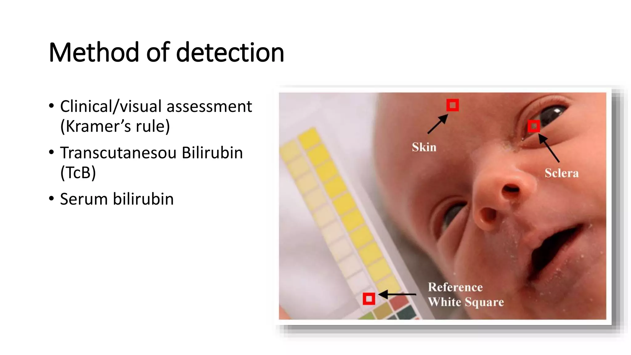 Kramer Test Neonatal jaundice Overview and management | PPTX