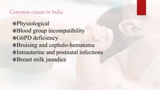 Common causes in India
Physiological
Blood group incompatibility
G6PD deficiency
Bruising and cephalo-hematoma
Intrauterine and postnatal infections
Breast milk jaundice
Teaching Aids:
N
J
-
1
7
 