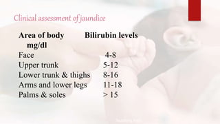 Clinical assessment of jaundice
Area of body Bilirubin levels
mg/dl
Face 4-8
Upper trunk 5-12
Lower trunk & thighs 8-16
Arms and lower legs 11-18
Palms & soles > 15
Teaching Aids:
N
J
-
1
9
 