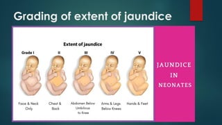 Grading of extent of jaundice
 