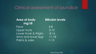 Clinical assessment of jaundice
Area of body Bilirubin levels
mg/dl
Face 4-8
Upper trunk 5-12
Lower trunk & thighs 8-16
Arms and lower legs 11-18
Palms & soles > 15
Teaching Aids:
 