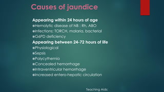 Causes of jaundice
Appearing within 24 hours of age
Hemolytic disease of NB : Rh, ABO
Infections: TORCH, malaria, bacterial
G6PD deficiency
Appearing between 24-72 hours of life
Physiological
Sepsis
Polycythemia
Concealed hemorrhage
Intraventricular hemorrhage
Increased entero-hepatic circulation
Teaching Aids:
 