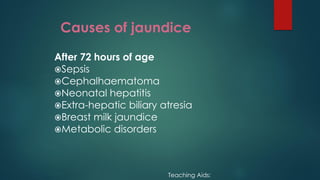 Causes of jaundice
After 72 hours of age
Sepsis
Cephalhaematoma
Neonatal hepatitis
Extra-hepatic biliary atresia
Breast milk jaundice
Metabolic disorders
Teaching Aids:
 