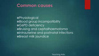 Common causes
Physiological
Blood group incompatibility
G6PD deficiency
Bruising and cephalhaematoma
Intrauterine and postnatal infections
Breast milk jaundice
Teaching Aids:
 