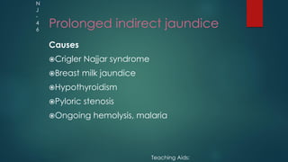 Prolonged indirect jaundice
Causes
Crigler Najjar syndrome
Breast milk jaundice
Hypothyroidism
Pyloric stenosis
Ongoing hemolysis, malaria
Teaching Aids:
N
J
-
4
6
 