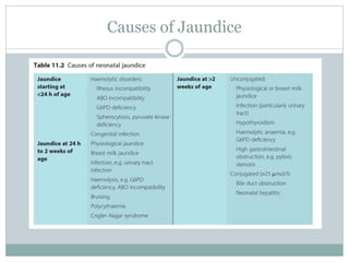 Causes of Jaundice
 