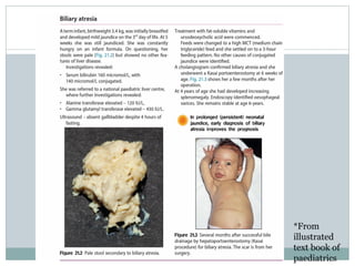 *From
illustrated
text book of
paediatrics
 