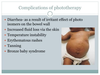 Complications of phototherapy
 Diarrhea- as a result of irritant effect of photo
isomers on the bowel wall
 Increased fluid loss via the skin
 Temperature instability
 Erythematous rashes
 Tanning
 Bronze baby syndrome
 