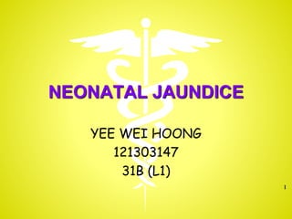 NEONATAL JAUNDICE
YEE WEI HOONG
121303147
31B (L1)
1
 