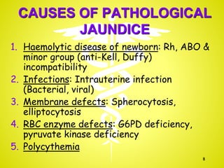 CAUSES OF PATHOLOGICAL
JAUNDICE
1. Haemolytic disease of newborn: Rh, ABO &
minor group (anti-Kell, Duffy)
incompatibility
2. Infections: Intrauterine infection
(Bacterial, viral)
3. Membrane defects: Spherocytosis,
elliptocytosis
4. RBC enzyme defects: G6PD deficiency,
pyruvate kinase deficiency
5. Polycythemia
8
 