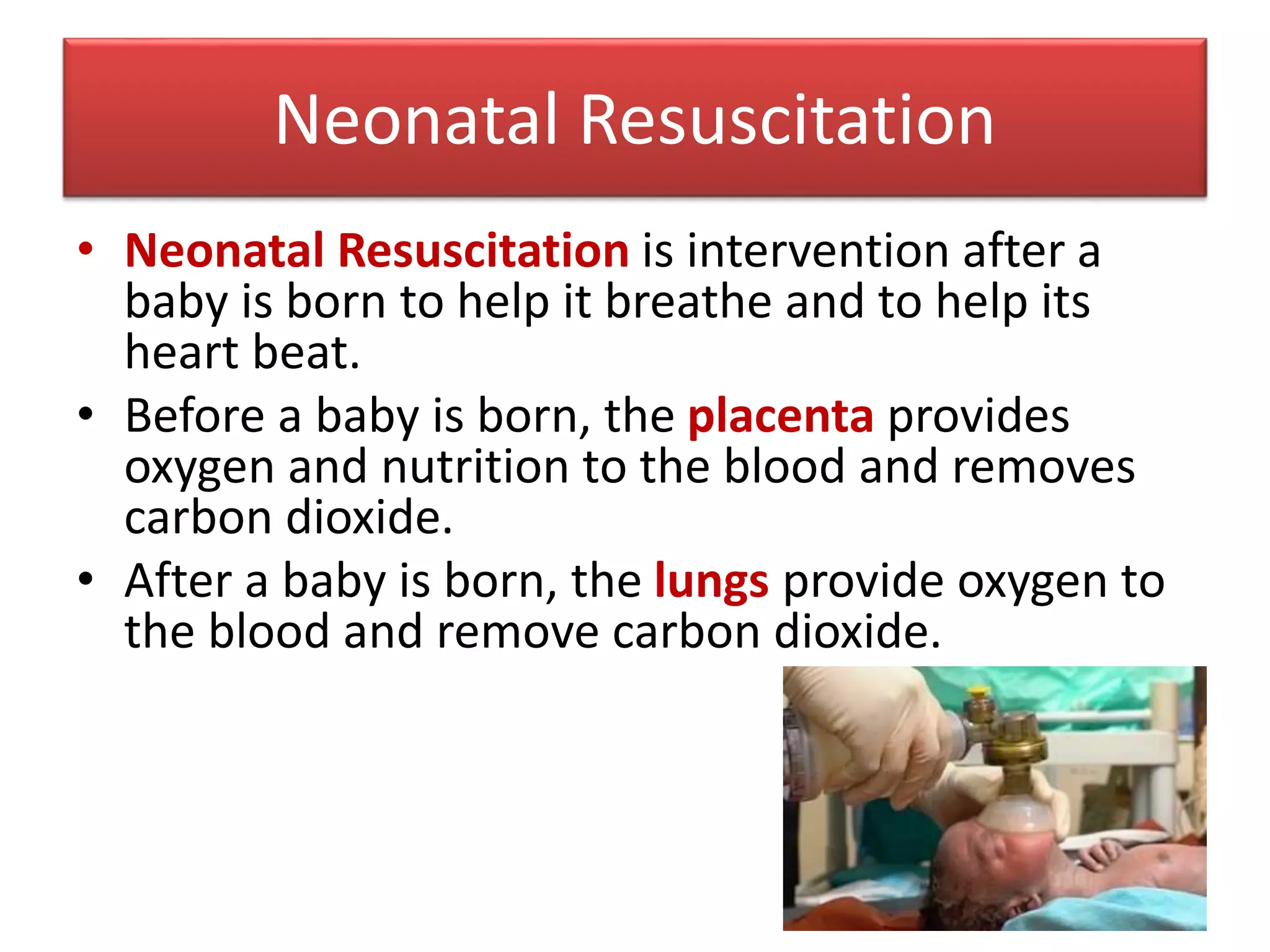 Neonatal life support | PPTX