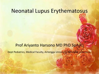 Neonatal Lupus Erythematosus
Prof Ariyanto Harsono MD PhD SpA(K)
Dept Pediatrics, Medical Faculty, Airlangga University, Surabaya, Indonesia.
1
 