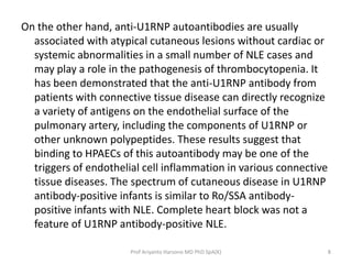 On the other hand, anti-U1RNP autoantibodies are usually
associated with atypical cutaneous lesions without cardiac or
sys...