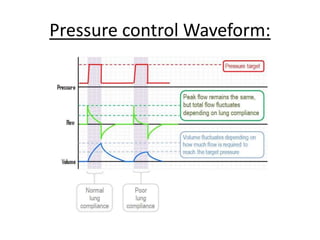 Pressure control Waveform:
 