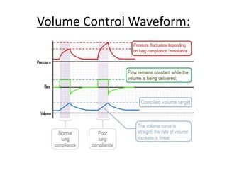 Volume Control Waveform:
 