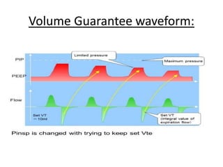 Volume Guarantee waveform:
 