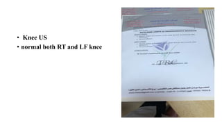 • Knee US
• normal both RT and LF knee
 