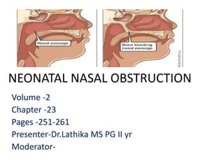 NEONATAL NASAL OBSTRUCTION
Volume -2
Chapter -23
Pages -251-261
Presenter-Dr.Lathika MS PG II yr
Moderator-
 