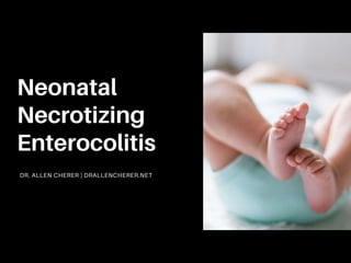 Neonatal Necrotizing Enterocolitis: Overview