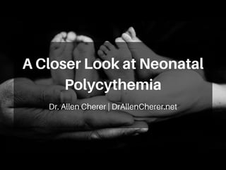 An Overview: Neonatal Polycythemia