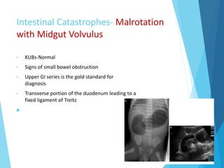 Intestinal Catastrophes- Malrotation
with Midgut Volvulus
• KUBs-Normal
• Signs of small bowel obstruction
• Upper GI series is the gold standard for
diagnosis
• Transverse portion of the duodenum leading to a
fixed ligament of Treitz

 