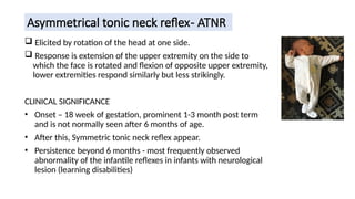 Atnr Testing neonatalreflex-230123071501-218e458a.pptx