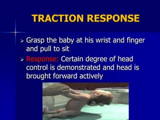 TRACTION RESPONSE

 Grasp the baby at his wrist and finger
  and pull to sit
 Response: Certain degree of head
  control is demonstrated and head is
  brought forward actively
 