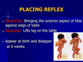 PLACING REFLEX

 Elicited by: Bringing the anterior aspect of tibia
  against edge of table
 Response: Lifts leg on the table



   Appear at birth and disapper
     at 6 weeks.
 