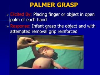 PALMER GRASP
 Elicited By: Placing finger or object in open
  palm of each hand
 Response: Infant grasp the object and with
  attempted removal grip reinforced
 