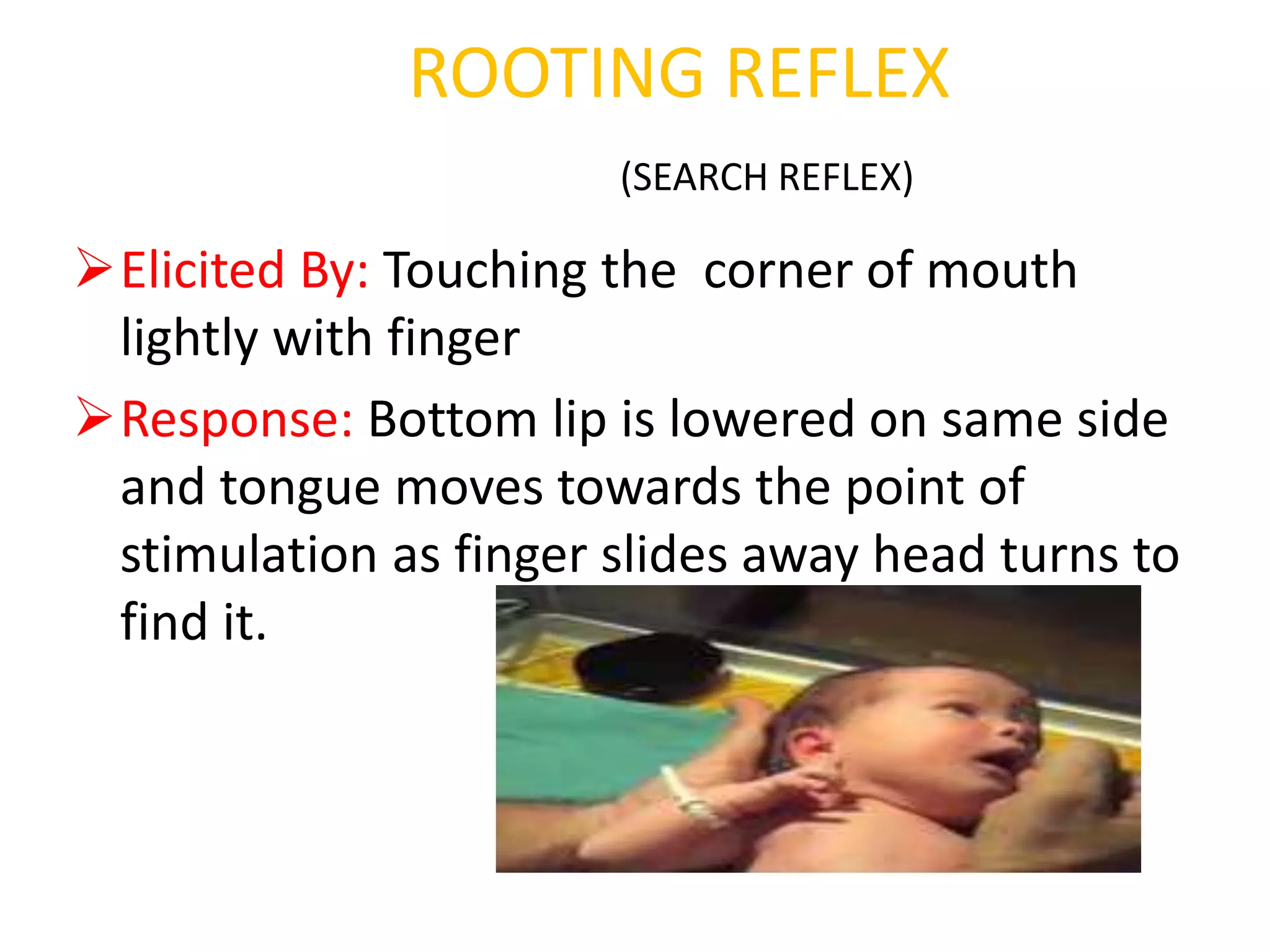 neonatal reflexes case presentation.pptx