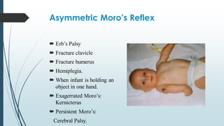 Comprehensive Guide to Primitive Neonatal Reflexes and Their Clinical ...