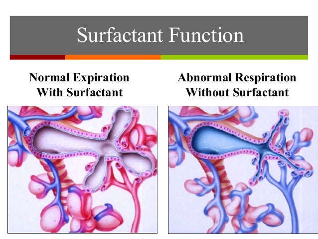 Neonatal Respiratory Distress