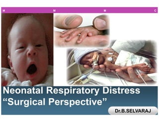 L/O/G/O
Neonatal Respiratory Distress
“Surgical Perspective”
Neonatal Respiratory Distress
“Surgical Perspective”
M M M C
Dr.B.SELVARAJ
 
