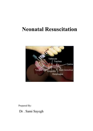 Neonatal Resuscitation
Prepared By:
Dr . Sami Sayegh
 