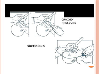 Nrp Motor Rotation neonatal resuscitation NRP - Copy.pptx