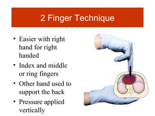 Two Hand Method Neonatal resuscitation 2012 AG | PPT