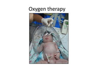 Oxygen therapy

 