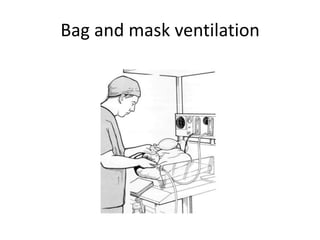 Bag and mask ventilation

 