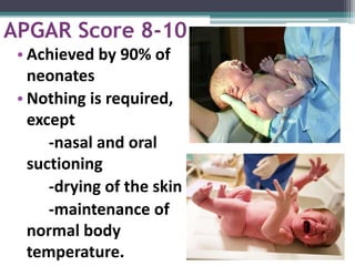 Neonatal resuscitation Slide 11