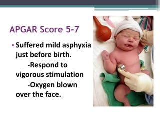 Neonatal resuscitation Slide 12