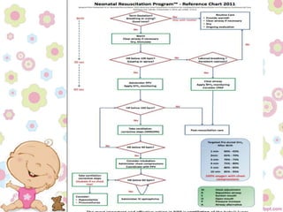Neonatal Resuscitation | PPTX