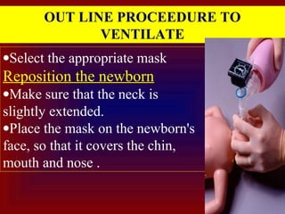 OUT LINE PROCEEDURE TO
VENTILATE
•Select the appropriate mask
Reposition the newborn
•Make sure that the neck is
slightly extended.
•Place the mask on the newborn's
face, so that it covers the chin,
mouth and nose .
 