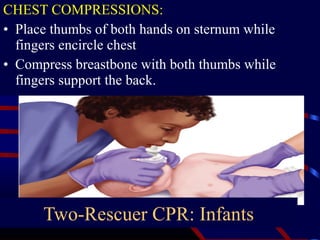 CHEST COMPRESSIONS:
• Place thumbs of both hands on sternum while
fingers encircle chest
• Compress breastbone with both thumbs while
fingers support the back.
Two-Rescuer CPR: Infants
 
