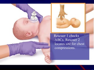 Rescuer 1 checks
ABCs. Rescuer 2
locates site for chest
compressions.
 
