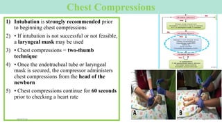 Chest Compressions
1) Intubation is strongly recommended prior
to beginning chest compressions
2) • If intubation is not successful or not feasible,
a laryngeal mask may be used
3) • Chest compressions = two-thumb
technique
4) • Once the endotracheal tube or laryngeal
mask is secured, the compressor administers
chest compressions from the head of the
newborn
5) • Chest compressions continue for 60 seconds
prior to checking a heart rate
09/07/16 38
 