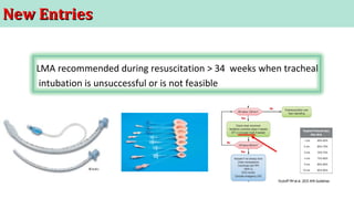 New EntriesNew Entries
LMA recommended during resuscitation > 34 weeks when tracheal
intubation is unsuccessful or is not feasible
 