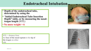 Endotracheal Intubation
• Depth of the endotracheal tube,
determined by using the
• “Initial Endotracheal Tube Insertion
Depth” table, or by measuring the nasal-
tragus length (NTL)
• No more weight + 6
NTL = distance from
the base of the nasal septum to the tip of
the tragus on either
side
09/07/16 42
 