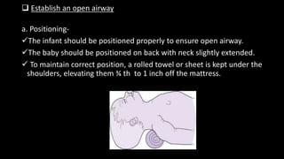  Establish an open airway
a. Positioning-
The infant should be positioned properly to ensure open airway.
The baby should be positioned on back with neck slightly extended.
 To maintain correct position, a rolled towel or sheet is kept under the
shoulders, elevating them ¾ th to 1 inch off the mattress.
 