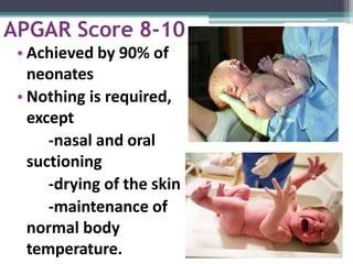 APGAR Score 8-10
• Achieved by 90% of
neonates
• Nothing is required,
except
-nasal and oral
suctioning
-drying of the skin
-maintenance of
normal body
temperature.
 