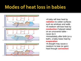 •A baby will lose heat by
radiation to colder surfaces
such as windows and walls
•A newborn will lose heat by
conduction if placed naked
on an uncovered table -
never do it
•Immediately after birth (or a
bath), a baby loses heat by
evaporation
•A draught may cause a
newborn to lose (or gain)
heat through convection
 